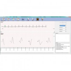 ECG PC SE-1010 Edan