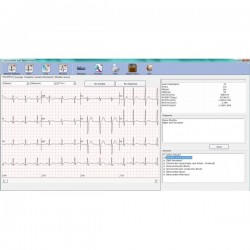 ECG PC SE-1010 Edan