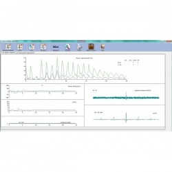 ECG PC SE-1010 Edan