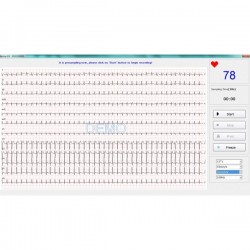 ECG PC SE-1010 Edan