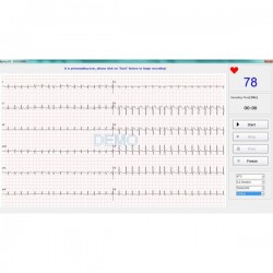 ECG PC SE-1010 Edan