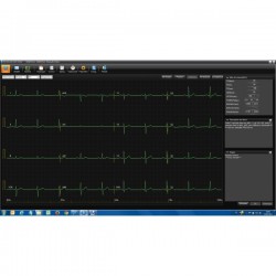 ECG PC SE-1515 DE 15 Edan