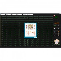 ECG PC SE-1515 DE 15 Edan