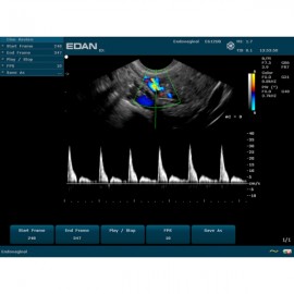 Echographe portable U50 Edan