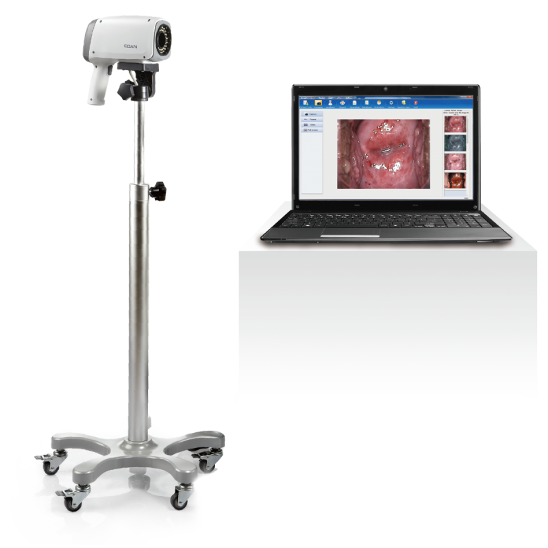 Colposcope C3A Edan Colposcope C3A Edan