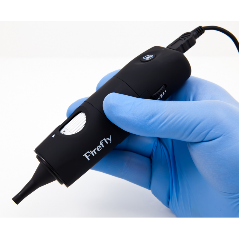 Otoscope digital FIREFLY DE500 teamalex medical