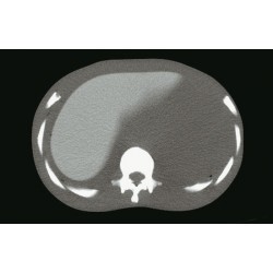mannequin_pour_la_radiographie