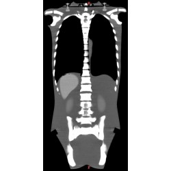 mannequin_pour_la_radiographie