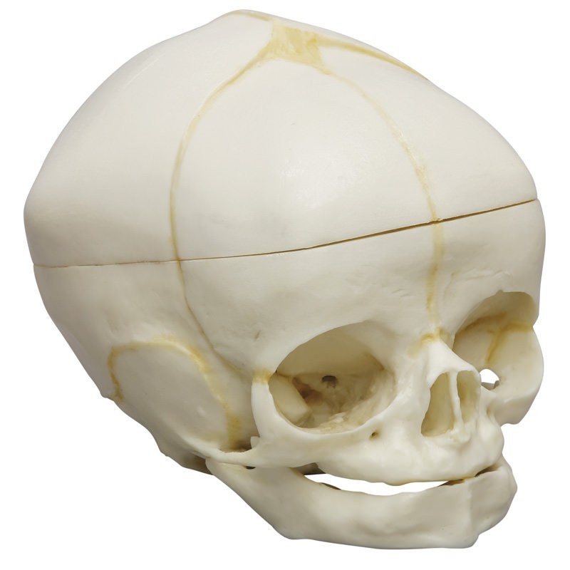 Crâne de fœtus 40 semaines avec coupe au calvaire