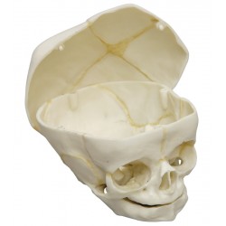 Crâne de fœtus 40 semaines avec coupe au calvaire