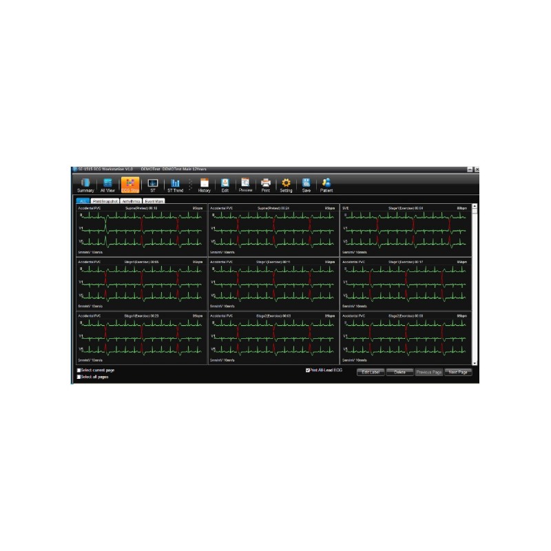 Edan logiciel SE-1515 gestion des données patients pour ECG teamalex