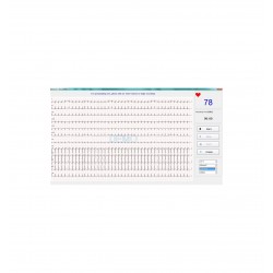 Edan ECG PC SE-1010 + Pack effort