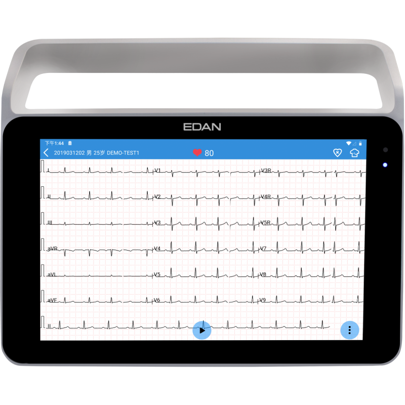 Edan ECG ISE sur tablette tactile avec poignée teamalex