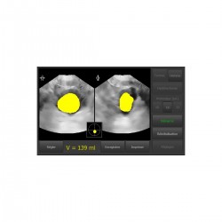 Bladder Scanner Vitascan LT Vitacon