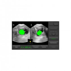 Bladder Scanner Vitascan LT Vitacon