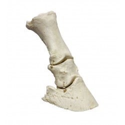 Pied de cheval articulé Teamalex Medical