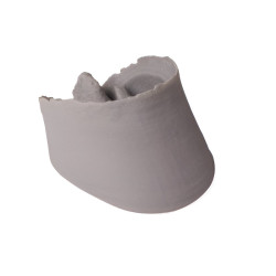 Capsule de sabot de cheval en 3D Teamalex Medical