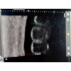 Simulateur rein de chien pour entraînement des ultrasons Teamalex Medical