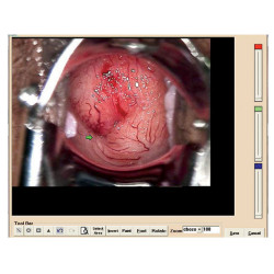 Logiciel pour colposcope 29620, 29600 (avec 29603) Teamalex Medical