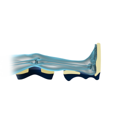 Coussins de positionnement pour les genoux (la paire) Teamalex Medical