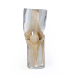 Fantôme de test pour radiographie – Genou transparent teamalex medical