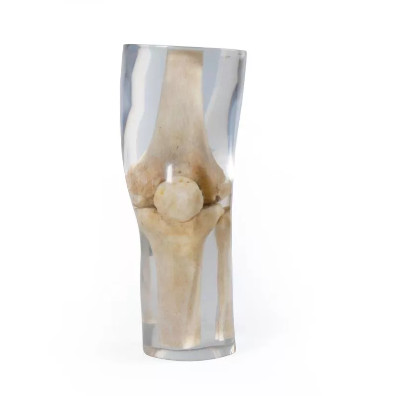 Fantôme de test pour radiographie – Genou transparent teamalex medical Fantôme de test pour radiographie – Genou transparent teamalex medical