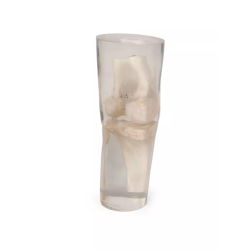 Fantôme de test pour radiographie teamalex medical