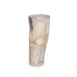 Fantôme de test pour radiographie – Genou transparent 7250 teamalex medical