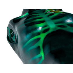 Echo Eddie – Simulateur d’échographie torse teamalex medical