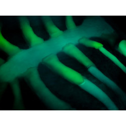 Echo Eddie – Simulateur d’échographie vue de pres teamalex