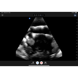 Echo Eddie – Simulateur d’échographie echographie teamalex medical