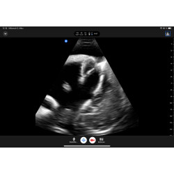 Echo Eddie – Simulateur d’échographie radio teamalex
