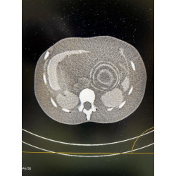 Echo Eddie – Simulateur d’échographie team alex medical