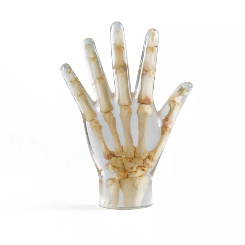 Fantôme de test radiographie main transparente teamalex medical Fantôme de test radiographie main transparente teamalex medical