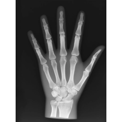 Fantôme de test radiographie main transparente radio teamalex