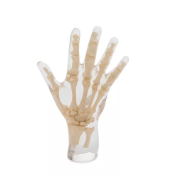Fantôme de test radiographie main transparente team alex medical