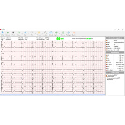 ecg teamalex