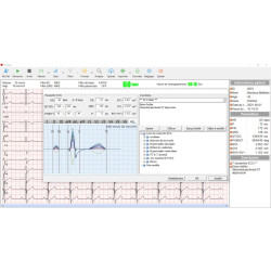 ecg logiciel teamalex