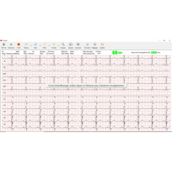 Logiciel pour PC-ECG et Cardiomate teamalex medical