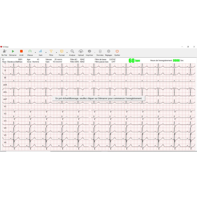 Logiciel pour PC-ECG et Cardiomate teamalex medical Logiciel pour PC-ECG et Cardiomate teamalex medical