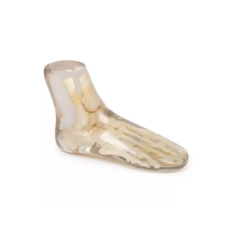 Fantôme test radiographie pied transparent teamalex medical Fantôme test radiographie pied transparent teamalex medical