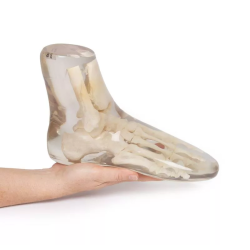 Fantôme test radiographie pied transparent teamalex Fantôme test radiographie pied transparent teamalex