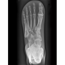 Fantôme test radiographie pied transparent Fantôme test radiographie pied transparent
