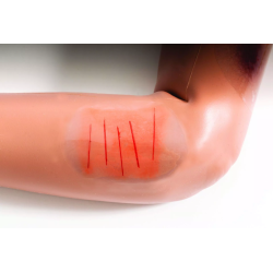 Simulateur de patient ado/jeune adulte teamalex medical