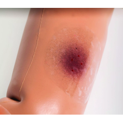 Simulateur de patient ado/jeune adulte teamalex