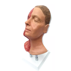 Tête pour les injections faciales avec les muscles, les artères et les nerfs teamalex medical