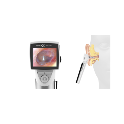 Otoscope digital SyncVision iO1 Elite teamalex medical