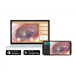 Otoscope digital SyncVision iO1 Elite teamalex medical