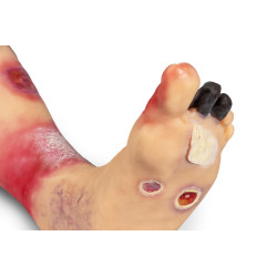 Simulateur médical – Jambe atteinte de pathologies Teamalex