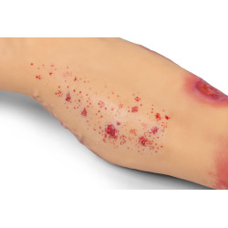 Simulateur médical – Jambe atteinte de pathologies Teamalex